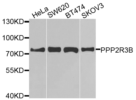 Rabbit anti-PPP2R3B Polyclonal Antibody