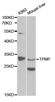 Rabbit anti-TPMT Polyclonal Antibody