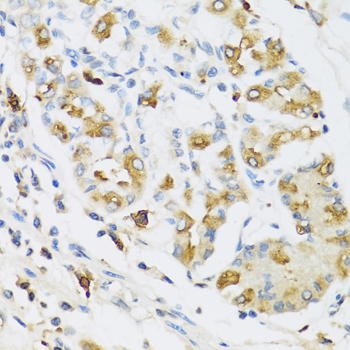 Rabbit anti-RNASE3 Polyclonal Antibody