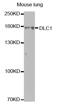 Rabbit anti-DLC1 Polyclonal Antibody