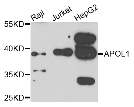 Rabbit anti-APOL1 Polyclonal Antibody