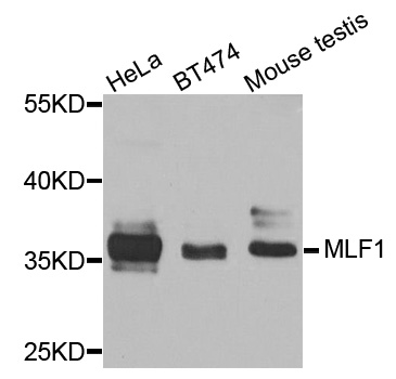 Rabbit anti-MLF1 Polyclonal Antibody