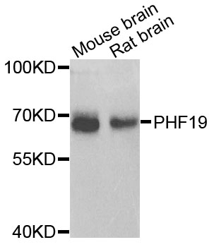 Rabbit anti-PHF19 Polyclonal Antibody