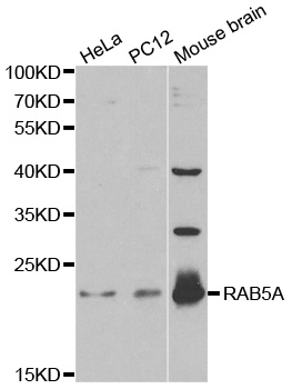 Rabbit anti-RAB5A Polyclonal Antibody