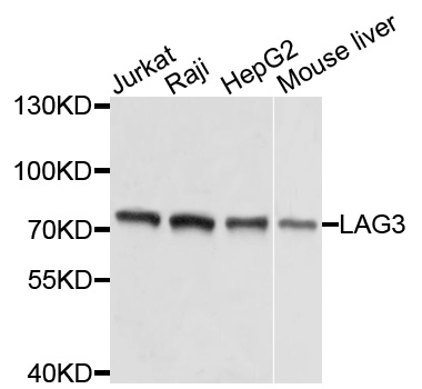 Rabbit anti-LAG3 Polyclonal Antibody