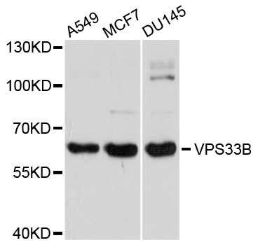 Rabbit anti-VPS33B Polyclonal Antibody