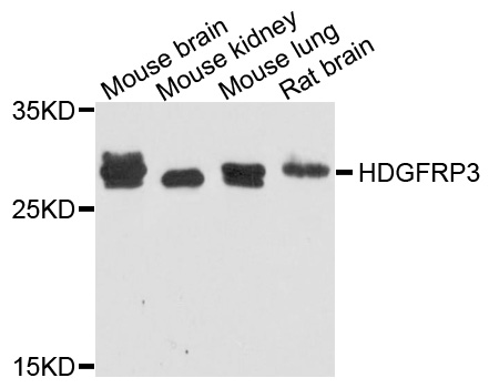 Rabbit anti-HDGFRP3 Polyclonal Antibody