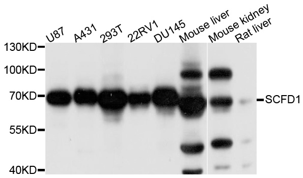 Rabbit anti-SCFD1 Polyclonal Antibody