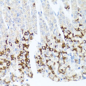 Rabbit anti-GPM6A Polyclonal Antibody