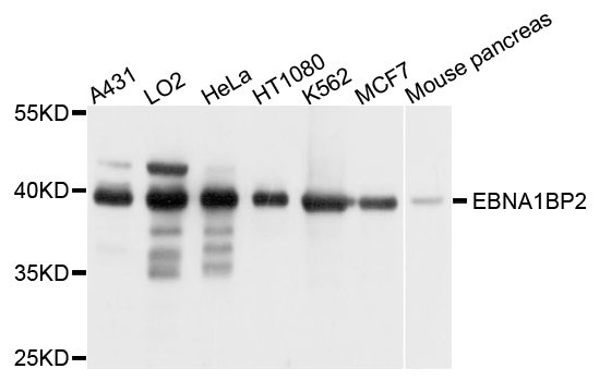 Rabbit anti-EBNA1BP2 Polyclonal Antibody