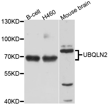 Rabbit anti-UBQLN2 Polyclonal Antibody