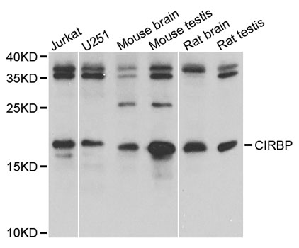 Rabbit anti-CIRBP Polyclonal Antibody