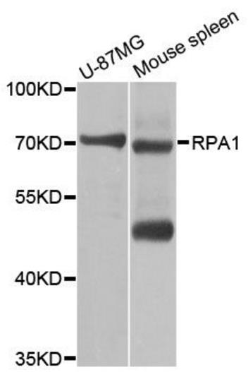 Rabbit anti-RPA1 Polyclonal Antibody