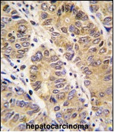 Rabbit anti-MMP13 Polyclonal Antibody(C-term)