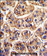 Rabbit anti-IFNAR1 Polyclonal Antibody(Center)