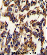 Rabbit anti-BSCL2 Polyclonal Antibody(N-term)
