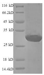 Recombinant Human EDN1 Protein(N-GST)