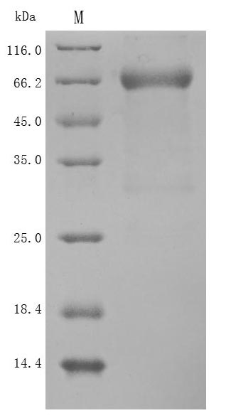 Recombinant Human SEMA4D Protein(C-6His)
