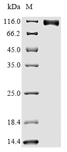 Recombinant Human EGFR Protein(N-10His,C-Myc)