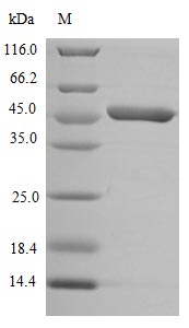 Recombinant Human CCR2 Protein(N-10His)
