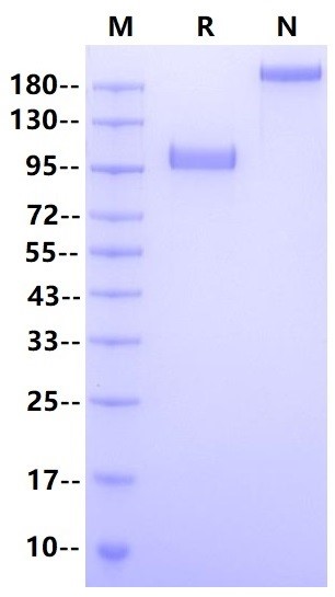 Recombinant Human Siglec-10 Protein(FC Chimera)