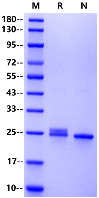 Recombinant Human CRP Protein(His Tag)