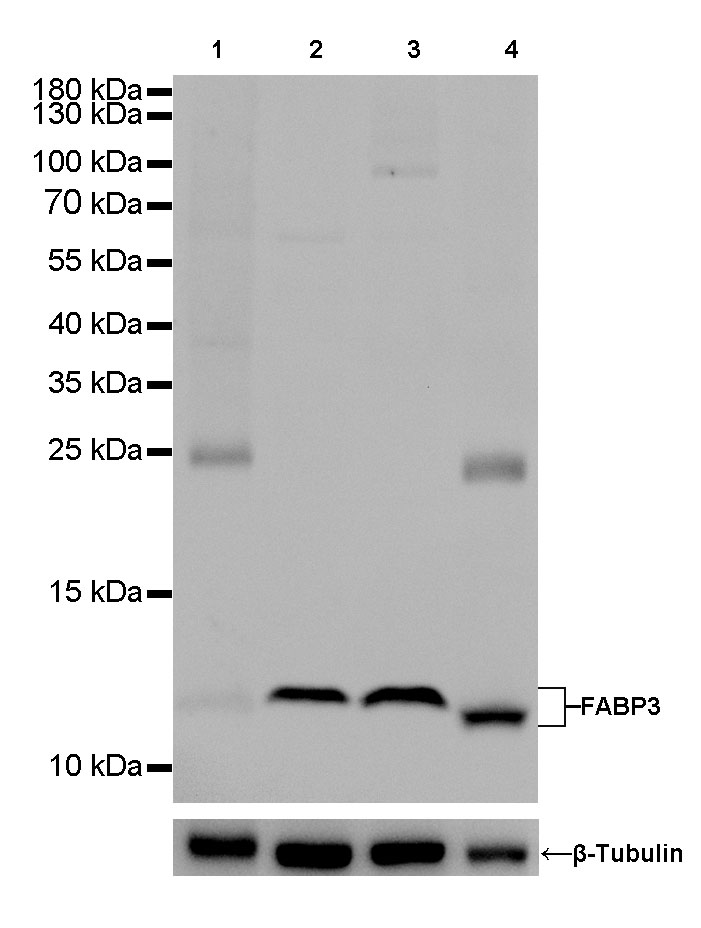 Rabbit anti-FABP3 Monoclonal Antibody(082-6)