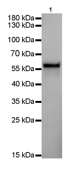 Rabbit anti-Keratin 5 Monoclonal Antibody(014-67)