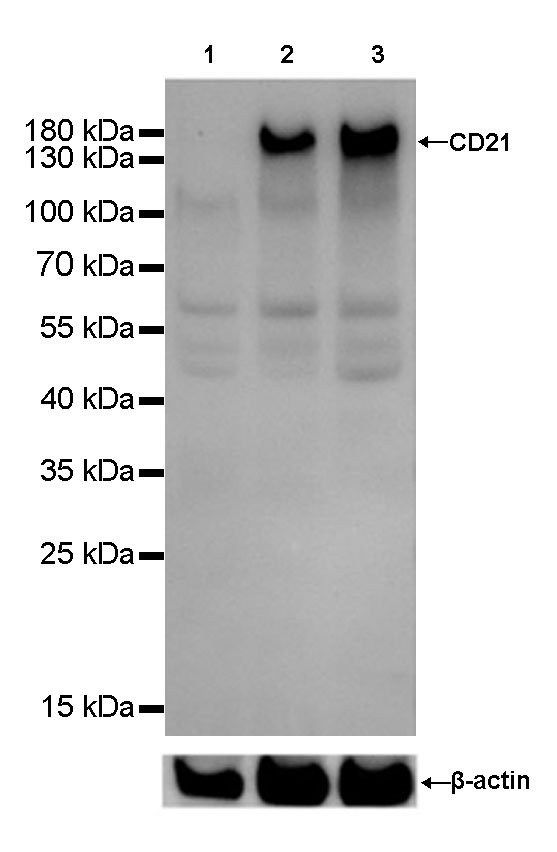 Rabbit anti-CD21 Recombinant Monoclonal Antibody(007-47)