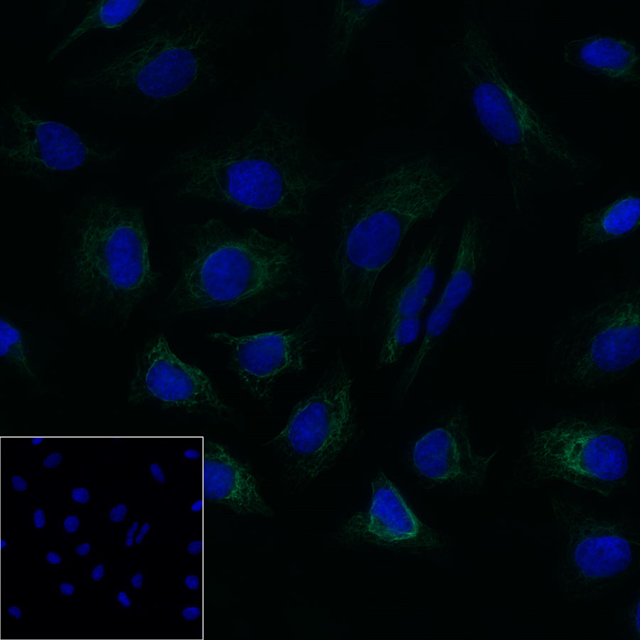Rabbit anti-CytokeRatin 7 Recombiant Monoclonal Antibody(121-17)