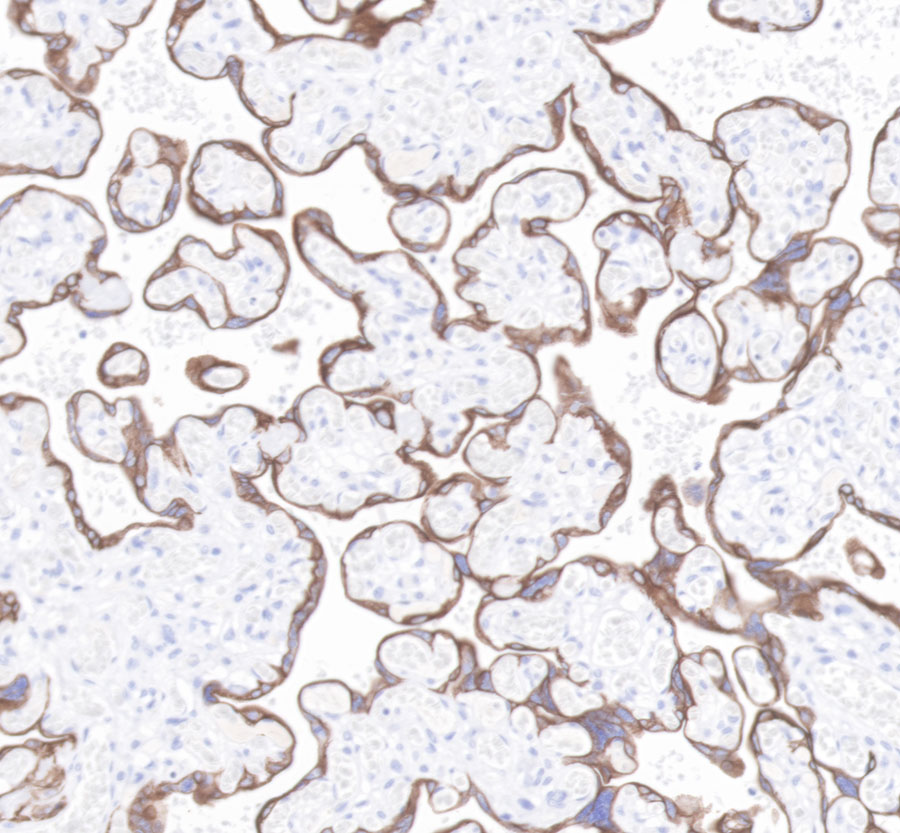 Rabbit anti-CytokeRatin 7 Recombiant Monoclonal Antibody(121-17)