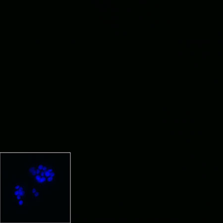 Rabbit anti-CytokeRatin 7 Recombiant Monoclonal Antibody(121-17)