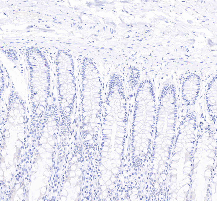Rabbit anti-CytokeRatin 7 Recombiant Monoclonal Antibody(121-17)