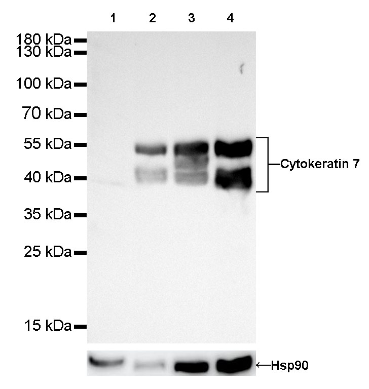Rabbit anti-CytokeRatin 7 Recombiant Monoclonal Antibody(121-17)