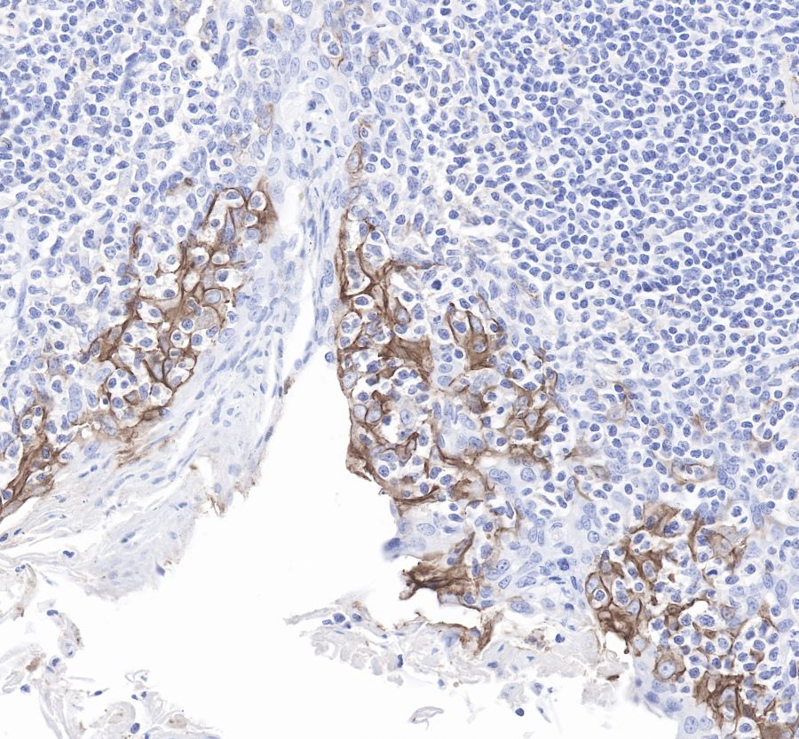 Rabbit anti-PD-L1 Recombinant Monoclonal Antibody(119-38)