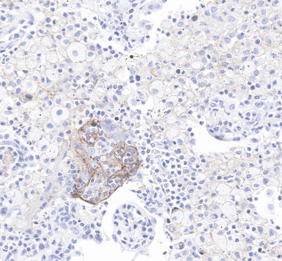 Rabbit anti-PD-L1 Recombinant Monoclonal Antibody(119-38)