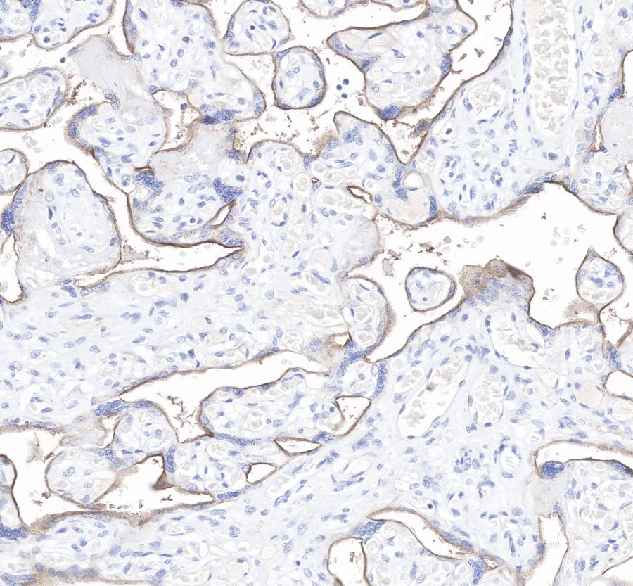 Rabbit anti-PD-L1 Recombinant Monoclonal Antibody(119-38)