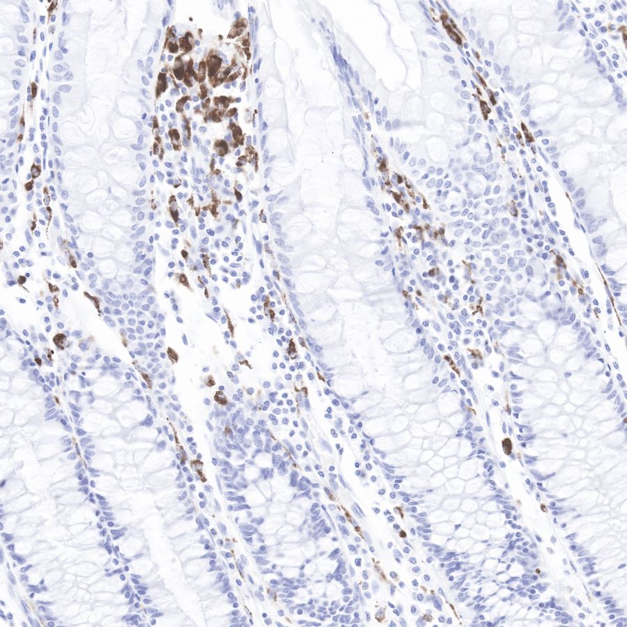 Rabbit anti-CD68 Recombinant Monoclonal Antibody(R025)