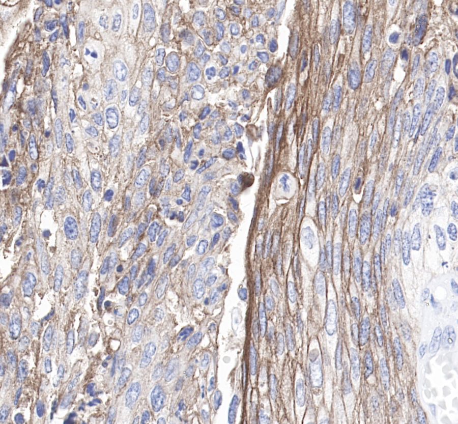 Rabbit anti-PD-L1 Recombinant Monoclonal Antibody(119-38)