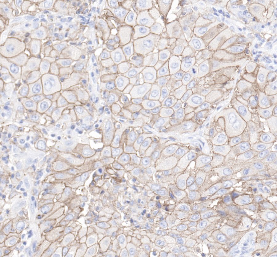 Rabbit anti-PD-L1 Recombinant Monoclonal Antibody(119-38)