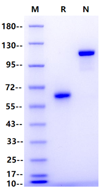 Recombinant Human Ephrin B3 Fc Chimera Protein(Human Fc Tag)