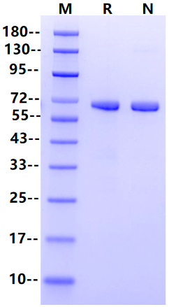 Recombinant Human ALPP Protein(His Tag)