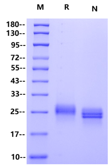 Recombinant Human Ephrin-A1 Protein(His Tag)