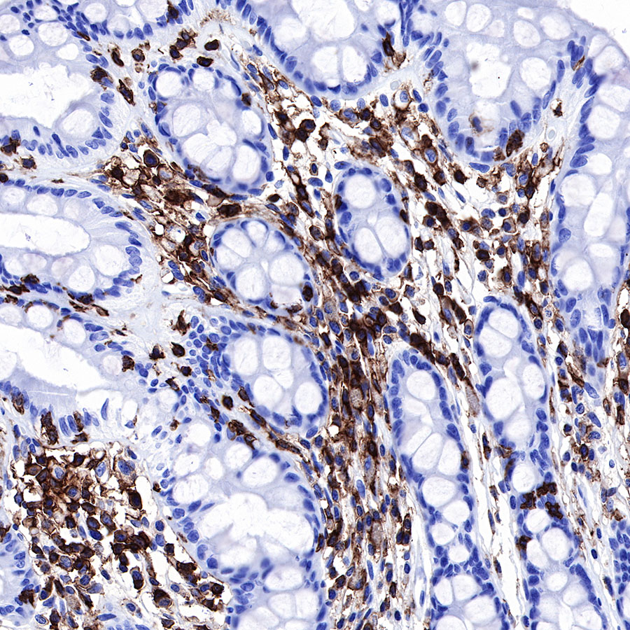 Rabbit anti-CD45 Recombinant Monoclonal Antibody(R035)