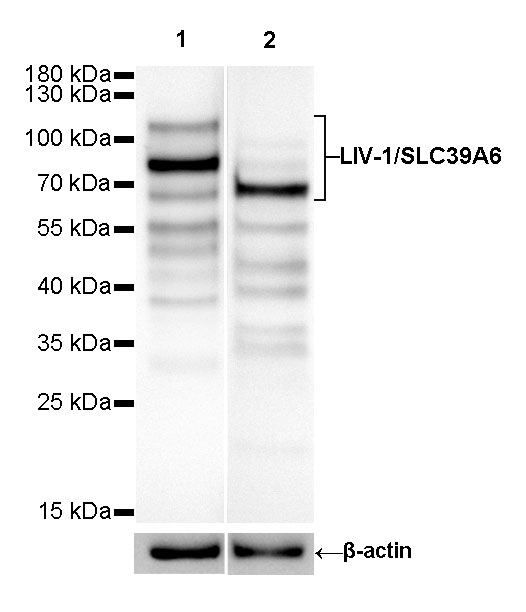 Rabbit anti-LIV-1/SLC39A6 Recombinant Monoclonal Antibody(206-84)