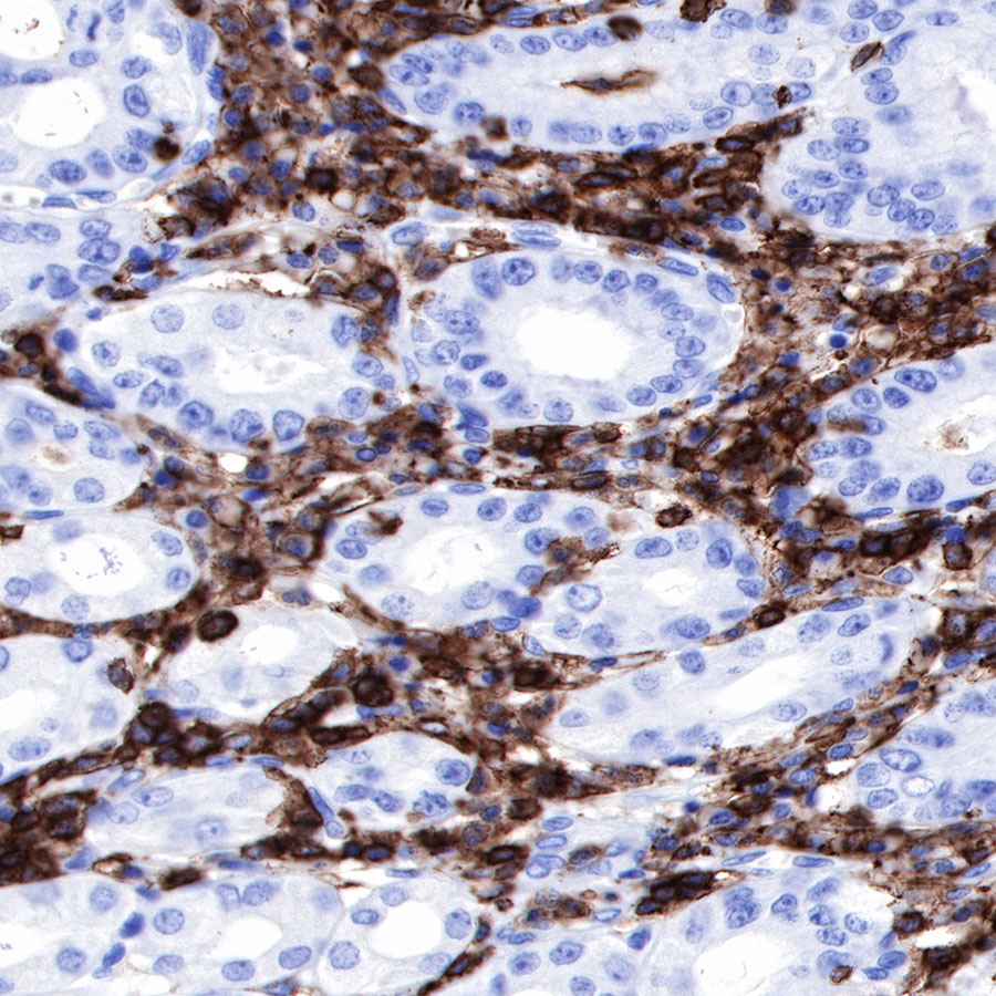 Rabbit anti-CD45 Recombinant Monoclonal Antibody(R035)