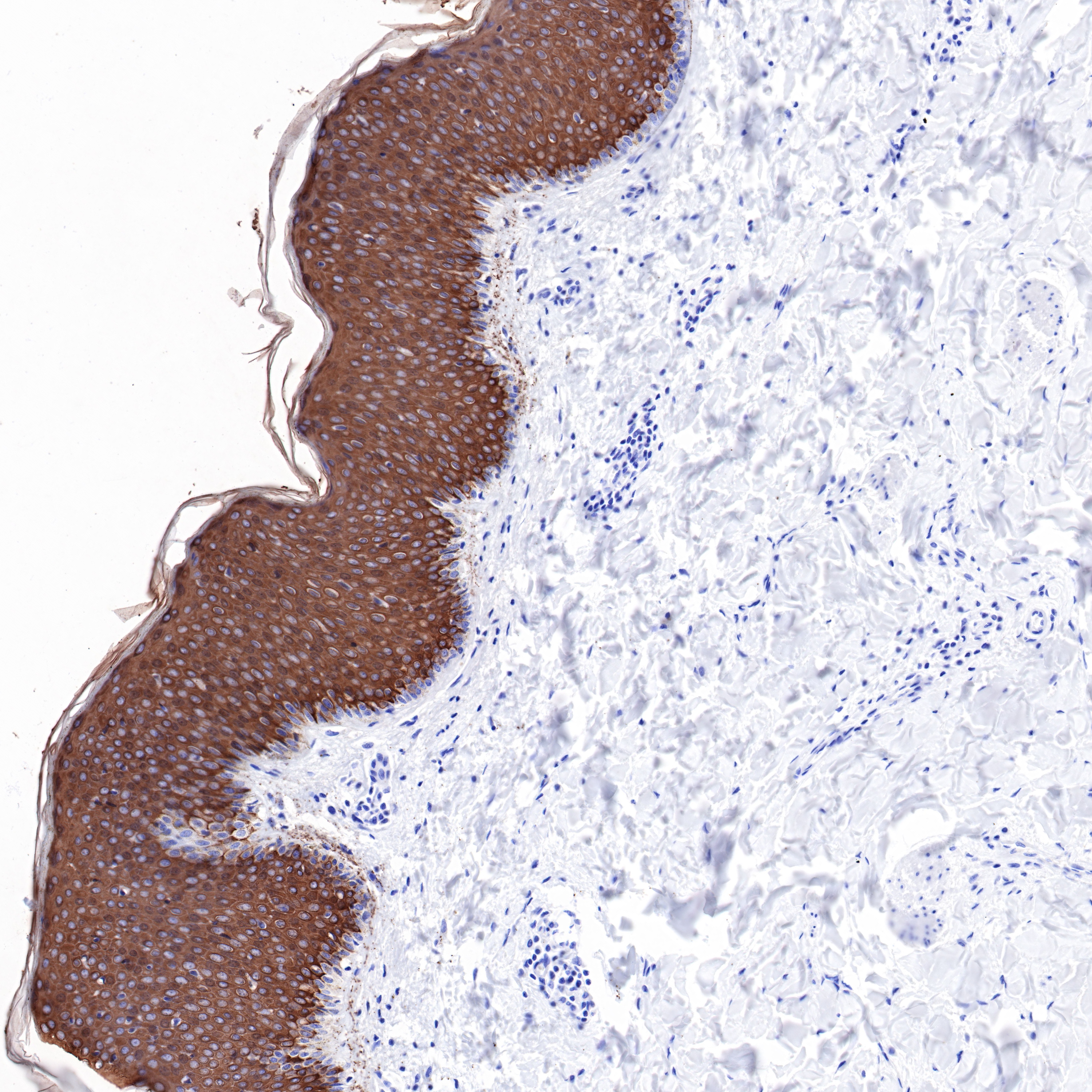 Rabbit anti-Keratin 10 Recombinant Monoclonal Antibody(R067)