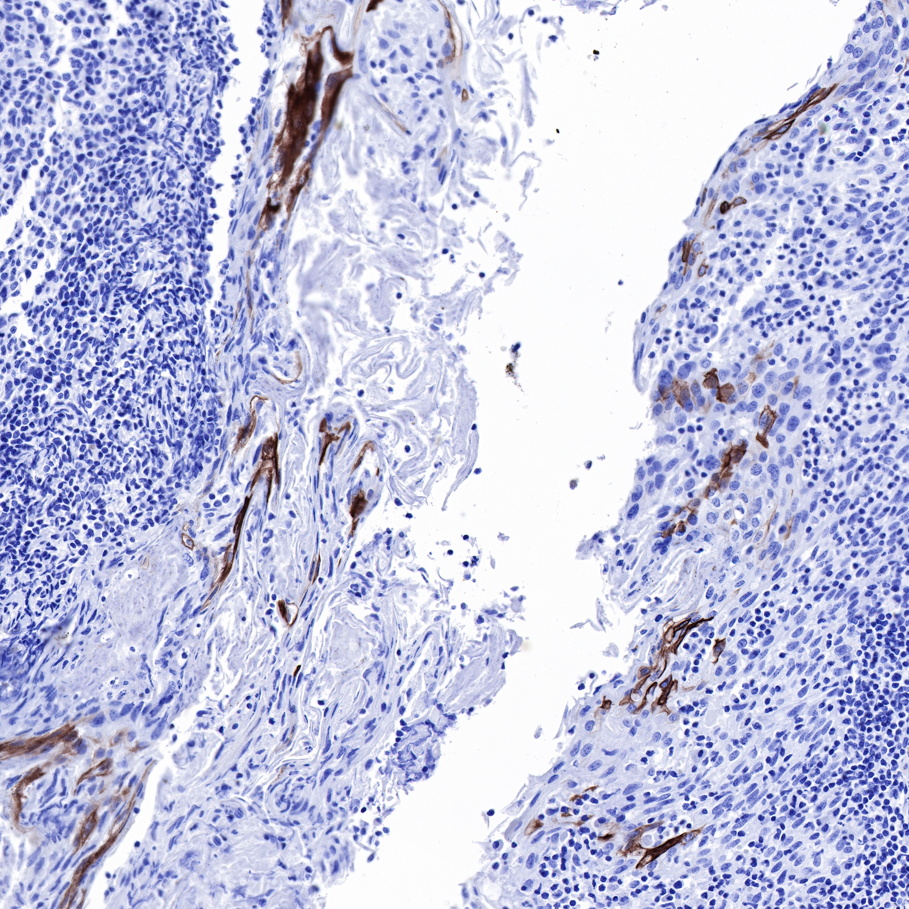 Rabbit anti-Keratin 10 Recombinant Monoclonal Antibody(R067)