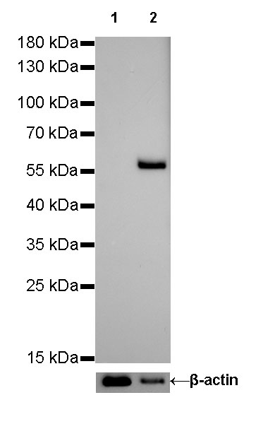 Rabbit anti-Keratin 10 Recombinant Monoclonal Antibody(R067)