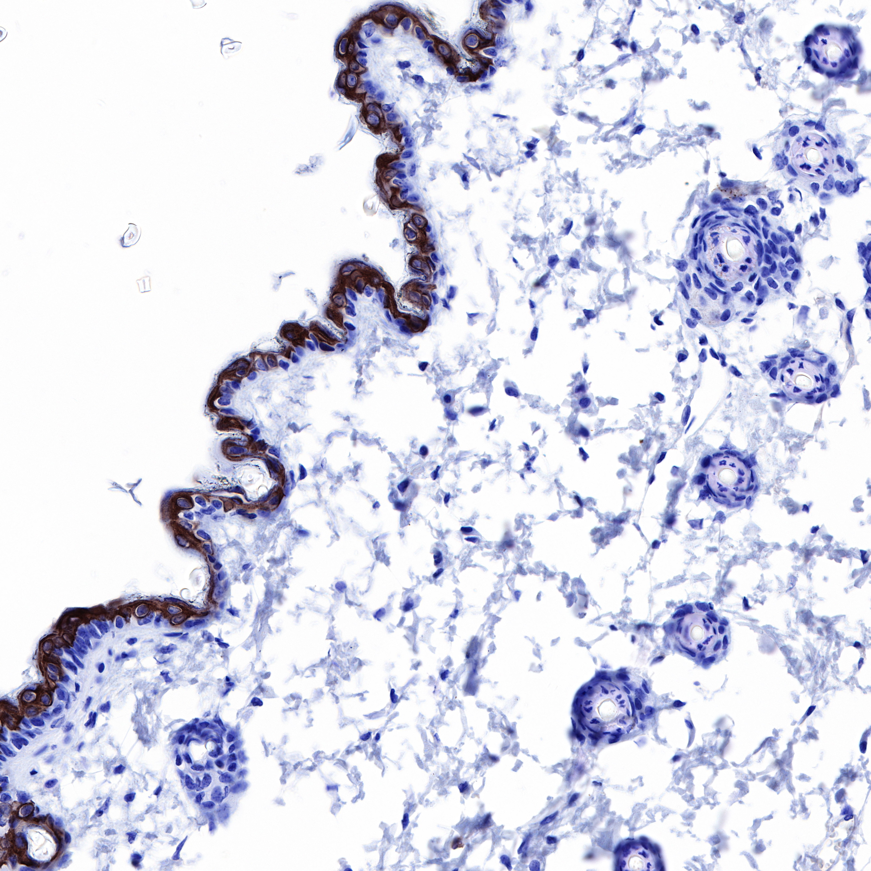 Rabbit anti-Keratin 10 Recombinant Monoclonal Antibody(R067)